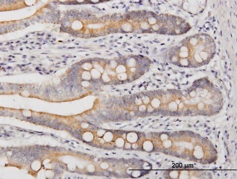 Monoclonal Anti-LIAS antibody produced in mouse clone 1C7, purified immunoglobulin, buffered aqueous solution