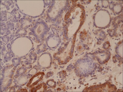 Anti-MUM1/IRF4 antibody, Rabbit monoclonal recombinant, expressed in HEK 293 cells, clone RM352, purified immunoglobulin