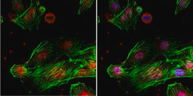 Anti-TLS Antibody, clone 1FU-1D2 ascites fluid, clone 1FU-1D2, from mouse