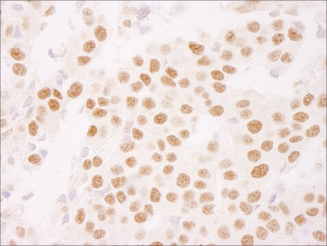 Rabbit anti-Ki-67 IHC Antibody, Affinity Purified Powered by Bethyl Laboratories, Inc.