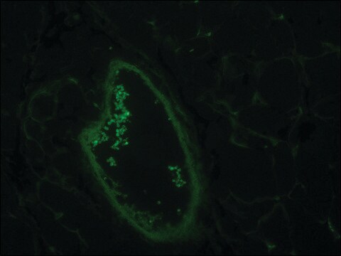 Monoclonal Anti-Actin, Smooth Muscle antibody produced in mouse ~1.0&#160;mg/mL, clone CGA7, purified immunoglobulin, buffered aqueous solution