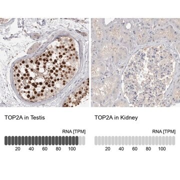 Anti-TOP2A antibody produced in rabbit Prestige Antibodies&#174; Powered by Atlas Antibodies, affinity isolated antibody, buffered aqueous glycerol solution, Ab2