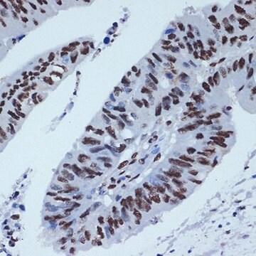 Anti-ZBTB7A/FBI-1/LRF antibody produced in rabbit