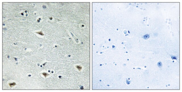 Anti-MTG16 antibody produced in rabbit affinity isolated antibody