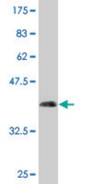 Monoclonal Anti-NPC2 antibody produced in mouse clone 4B9, purified immunoglobulin, buffered aqueous solution