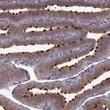 Anti-MTR antibody produced in rabbit Prestige Antibodies&#174; Powered by Atlas Antibodies, affinity isolated antibody