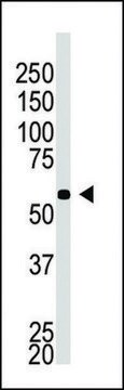 ANTI-BACE2C(C-TERMINAL) antibody produced in rabbit IgG fraction of antiserum, buffered aqueous solution