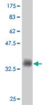 Monoclonal Anti-MSMB antibody produced in mouse clone 3B11, purified immunoglobulin, buffered aqueous solution