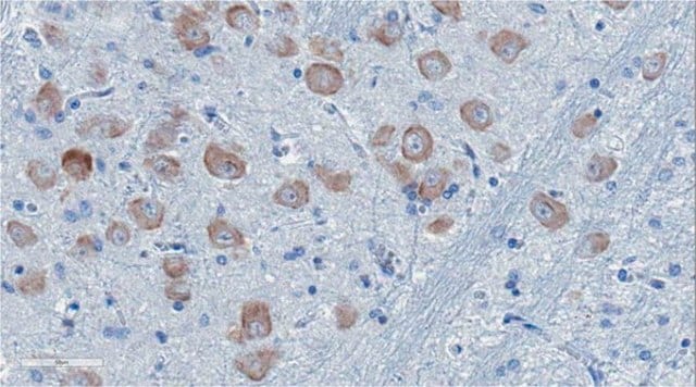 Anti-ApoE4 Fragment nApoECF Antibody (Asp172) from rabbit, purified by affinity chromatography