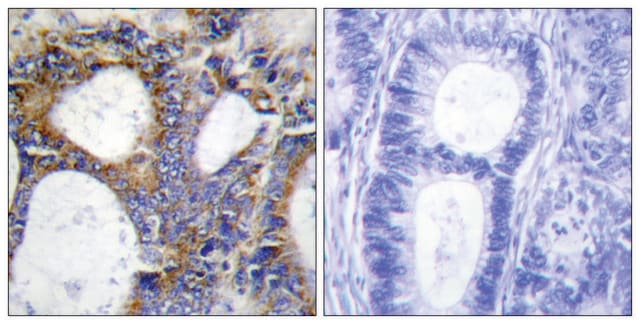 Anti-Collagen I &#945;2 antibody produced in rabbit affinity isolated antibody