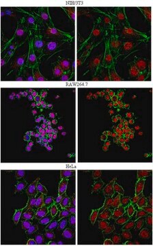 Anti-FOXP1 Antibody from rabbit, purified by affinity chromatography