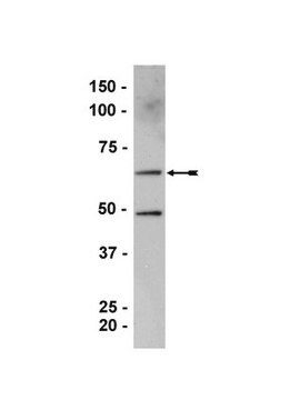 Anti-ZONAB Antibody serum, Upstate&#174;