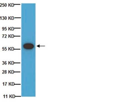 Anti-Tyrosine Hydroxylase Antibody, phosphoSer 40 Chemicon&#174;, from rabbit