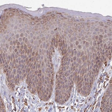 Anti-PPP1R13L antibody produced in rabbit Prestige Antibodies&#174; Powered by Atlas Antibodies, affinity isolated antibody, buffered aqueous glycerol solution