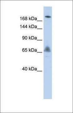 Anti-VPS8 antibody produced in rabbit affinity isolated antibody