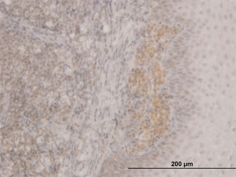 ANTI-FOXO3A antibody produced in mouse clone 2C4, purified immunoglobulin, buffered aqueous solution