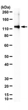 Anti-TPO Antibody, clone 47