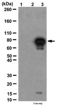 Anti-acetyl-p53 (Lys320) Antibody from rabbit, purified by affinity chromatography