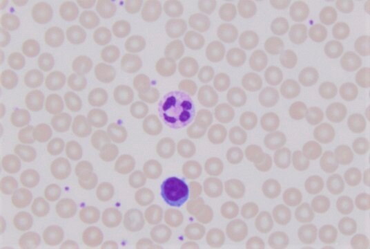 Giemsa Stain, Modified