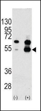 ANTI-VEGF1(N-TERMINAL) antibody produced in rabbit IgG fraction of antiserum, buffered aqueous solution