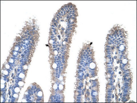 Anti-OTC antibody produced in rabbit IgG fraction of antiserum