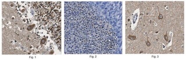 Anti-ARL13B Antibody from rabbit, purified by affinity chromatography