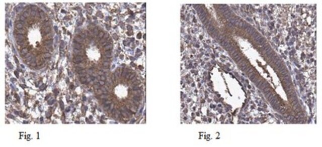 Anti-hyaluronan synthase 1 Antibody, clone 12A2.3 clone 12A2.3, from mouse