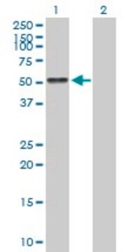 Anti-AGT antibody produced in mouse purified immunoglobulin, buffered aqueous solution