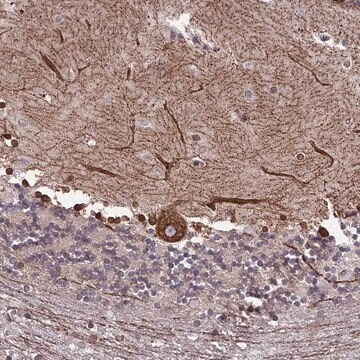 Anti-PTCHD4 antibody produced in rabbit Prestige Antibodies&#174; Powered by Atlas Antibodies, affinity isolated antibody, buffered aqueous glycerol solution