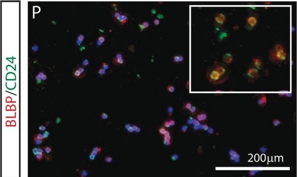 Anti-Brain lipid binding protein Antibody from rabbit, purified by affinity chromatography