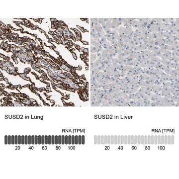 Anti-SUSD2 antibody produced in rabbit Prestige Antibodies&#174; Powered by Atlas Antibodies, affinity isolated antibody, buffered aqueous glycerol solution