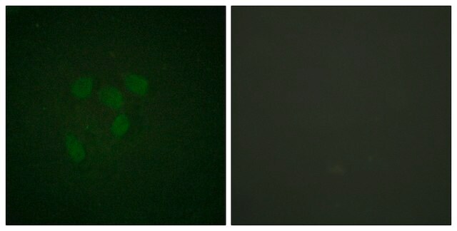 Anti-Acetyl (Lys 319) p53 Antibody, C-Terminal antibody produced in rabbit affinity isolated antibody