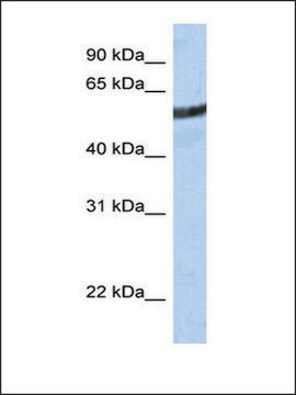 Anti-ME3 antibody produced in rabbit affinity isolated antibody