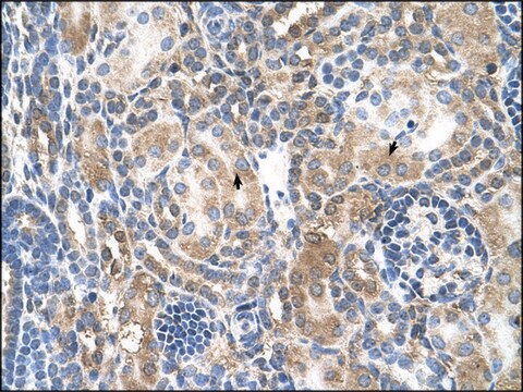 Anti-NR3C2 antibody produced in rabbit IgG fraction of antiserum