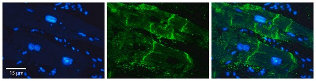 Anti-ATP1B1, (N-terminal) antibody produced in rabbit affinity isolated antibody