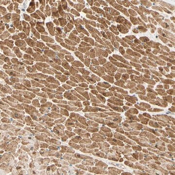 Anti-ADAM17 antibody produced in rabbit Prestige Antibodies&#174; Powered by Atlas Antibodies, affinity isolated antibody, buffered aqueous glycerol solution