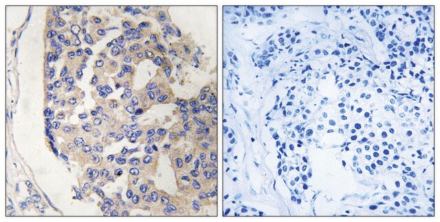 Anti-C1S, C-Terminal antibody produced in rabbit affinity isolated antibody