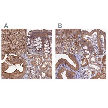 Anti-STUB1 antibody produced in rabbit Prestige Antibodies&#174; Powered by Atlas Antibodies, affinity isolated antibody, buffered aqueous glycerol solution