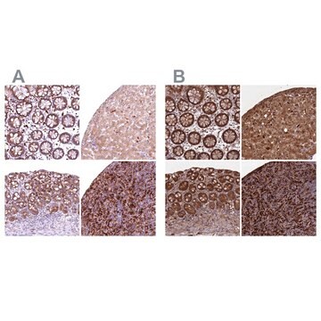 Anti-BLVRB antibody produced in rabbit Prestige Antibodies&#174; Powered by Atlas Antibodies, affinity isolated antibody, buffered aqueous glycerol solution