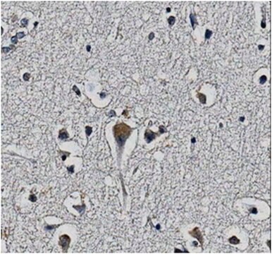 Anti-KChIP2 potassium channel subunit Antibody, clone 60/73 clone 60/73, from mouse