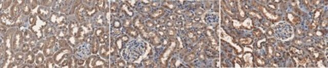 Anti-AGE Antibody, Methylglyoxal Antibody, clone 3D11 clone 3D11, from mouse