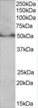 Anti-PPAR &#948; (Isoform 1) antibody produced in goat affinity isolated antibody, buffered aqueous solution