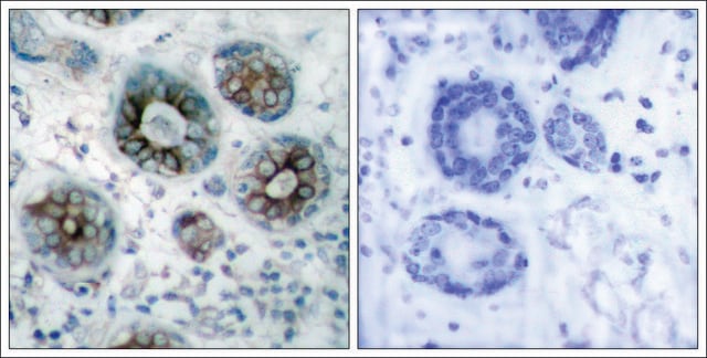 Anti-GAP43 (Ab-41) antibody produced in rabbit affinity isolated antibody