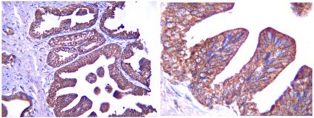 Anti-Interferon Beta Antibody serum, from rabbit