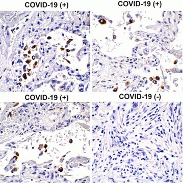 Anti-SARS-CoV-2 (COVID-19) Spike S1 antibody produced in rabbit affinity isolated antibody