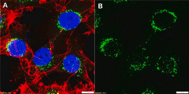 Anti-QSOX1 Antibody, clone MAb492.1