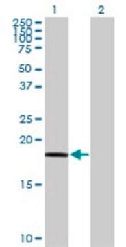 Monoclonal Anti-RARRES3 antibody produced in mouse clone 1H5, purified immunoglobulin, buffered aqueous solution