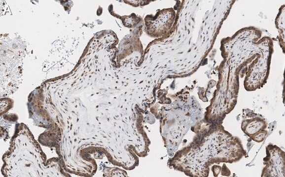 Anti-MOSPD2 Antibody, clone 3C20 ZooMAb&#174; Rabbit Monoclonal recombinant, expressed in HEK 293 cells