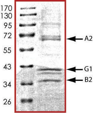 AMPK (&#945;2/&#946;2/&#947;1), active, His tagged human PRECISIO&#174; Kinase, recombinant, expressed in baculovirus infected Sf9 cells, &#8805;70% (SDS-PAGE), buffered aqueous glycerol solution