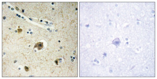 Anti-Collagen IV &#945;4 antibody produced in rabbit affinity isolated antibody